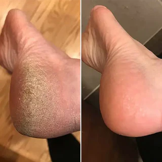 Review foto